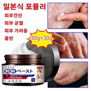 건선 건선 크림 습진 두드러기 피부 가려움증 보습 크림, 2개, 30g