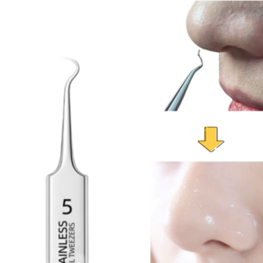 InLoop 피지제거기 초정밀 블랙헤드 핀셋 전문가용 모공 압출