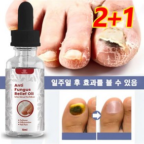 발톱 무좀 케어 손톱진균 발톱무좀 큐티클 트리트먼트 에센스