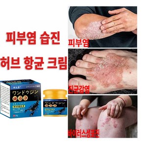 항균소염크림 건선/습진/붉은피부/모기물림/ 두드러기/피부염/두피선/피부소양증, 1개, GH12