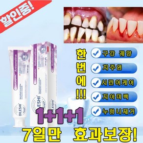 [가성비 최고] 미국 잇몸 재생 잇몸치약 구취제거 이빨 염증 예방 천연 무불소 화이트닝 엔치약 입냄새제거/구취케어/치석제거/충치 예방, 3개, 100ml