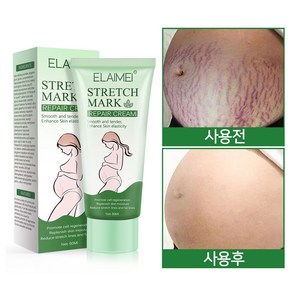 튼살크림 임산부 튼살관리 산후 튼살 제거, 2개, 60ml