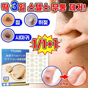 [효과보증!!] 피부 제거 패치 얼굴 바디 손 발바닥 피부 치료 스텔스 라벨 포장증정, 144매입, 1개