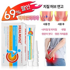 [국내발송]치질크림 배변 곤란 케어 항문 가려움증 크림 스테로이드프리 사타구니 가려움증 시크릿 존 케어 크림, 2개, 42.5g