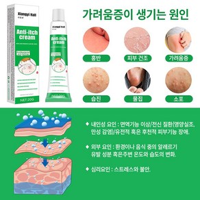 [치료 효과99.99%]두드러기건선완선사타구니습진소양증피부가려움연고Y003, 2개, 20g