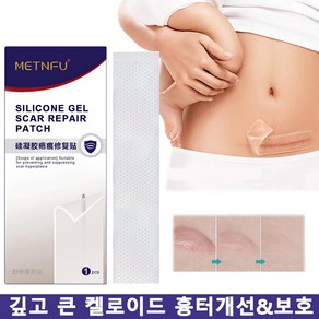 실리콘 젤시트 흉터 관리 패치 임산부 산전후 튼살 탄력케어 크림 임산부 청소년 이용가능, 2개, 투명