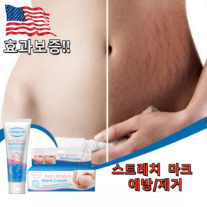 CARVENCHY 튼살 크림 임산부크림 임산부 전용 안전하다 부담제로, 4개, 60ml