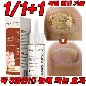 최신 기술 1/1+1 딱 3일!!! 효과보장 발톱 완화 영양제 천연 성분 손톱 리페어 에센스