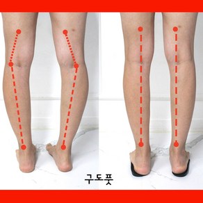 [1+1] 오다리 깔창 x다리 오다리용 팔자걸음 휜다리 걸음걸이 교정 2켤레, 2세트
