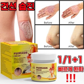 [빨른 배송] 미국 건선 연고 치료제 두드러기 가려움 연고 피부 가려움증 허브 크림, 1개, 20g