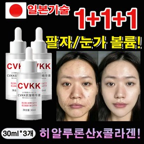 [일본기술] 1/1+1 저분자 히알루론산 콜라겐 앰플 주름개선 에센스 기미 미백 탄력 목주름 팔자주름 눈밑주름 케어 보습 광채 리프팅 안티에이징 앰플, 3개, 30ml