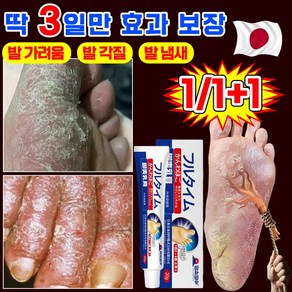 [국내당일배송] 일본 발 가려움 치료 연고 발바닥 발가락 발냄새 제거 크림 문제성발 완화 포장증정, 2개, 20g