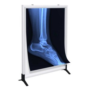 XRAY 판독대 뷰박스 치과 외과 LED 정형 병원 판독기, 1개