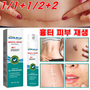 [국내배송] 상처 흉터 제거 피부 재생크림 제왕절개 수술흉터 화상 흉터 케어 미스트, 3개
