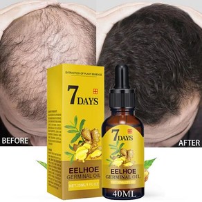 탈모 7 Days Ginge Essential Hai Gowth Oil Liquid Anti Hai Loss Baldness Remedy Boost Gow Thicke, 01 10ml, 1개, 20ml