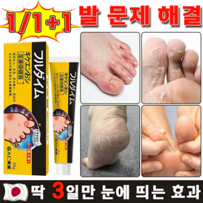 [국내 배송] 일본 발 가려움 연고 발바닥 발가락 가려움증 완화 발냄새 제거 크림 진균 리페어 곰팡이 살균 발톱 케어, 4개, 20g