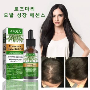 AKOLA [일일 혜택] 로즈마리 추출물 두피 토닉 탈모 예방 탈모 증상 완화 두피 영양 공급 모발 성장 촉진 두피 추출물 헤어 오일, 1개, 30ml