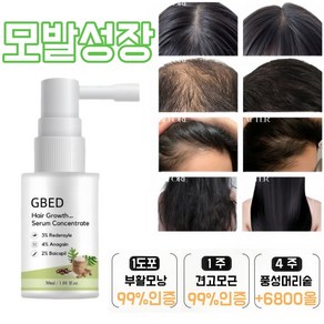 GBED 탈모 스프레이 모발 성장액 탈모 예방 미스트 생강 발모 촉진 영양제, 1개, 30ml