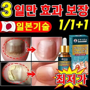 {일본 수입} 100% 두꺼운 손발톱 곰팡이 제거오래된 회색 손톱 제거기타 모든 손톱 트리트먼트 LY023, 2개, 20g