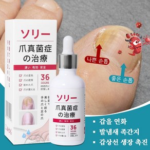 손발톱영양제 발톱 리페어에센스 문제성 손발톱 케어제 발톱무좀약, 2개, 50ml