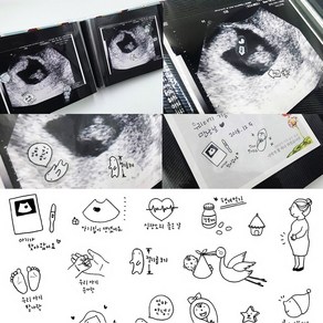 임신 주수 스티커 초음파 앨범 접착식 포토 사진 꾸미기 보관 태교 태아 일기, 투명 초음파앨범용 스티커5종(뱀띠)