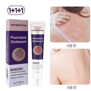 DRYMATYINE 건선 크림 습진크림 발진 가려움 두피건선 가려움완화, 20ml, 3개