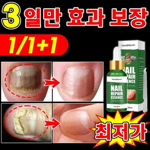 국내당일출고] 손톱 발톱 앰플 손발톱 영양제 네일 케어 문제성발톱 진균 발톱강화 관리 효과 짱, 2개, 30ml