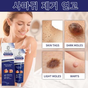 1+1얼굴 피부 깨끗해짐 제거 연고 쾌속적 유효 제거 얼굴 목 부분 기미 제거 크림