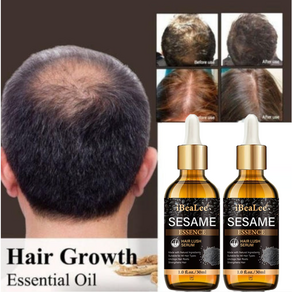 [효과보장] 1/1+1/2+2 머리 성장 에센스 두피케어 세럼 방지 완화 영양 에센스, 4개, 30ml