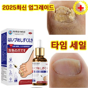 [100% 제거/일본수입] 발톱무좀 손발톱 영양제 강화 손발톱 영양제, 1개, 30ml