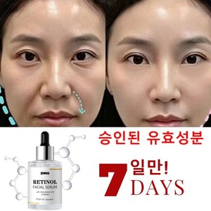 레티놀 에센스 히알루론산 5% 정교한 피부 완성, 4개, 45ml