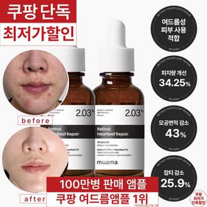3일 여드름 재생진정 흉터 개선 앰플 [100만병 판매기념 한정 할인] [여드름 흉터 & 좁쌀 피지 개선 임상완료] 레티놀 어성초 히알루론산 나이아신아마이드 뮤아마 앰플, 2개, 30ml