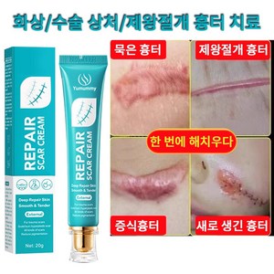 피부 관리 흉터 연고 화상 흉터 연고 화상연고, 2개, 20ml