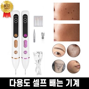 [깨끗하게 제거!!] 셀프 얼굴 기미잡티 제거 기계 플리즈마 잡티 지우개 기계 손 목 빼는 기계 포장증정, 골드
