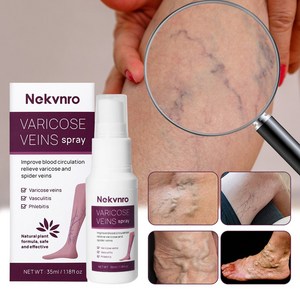 Nekvnro 하지정맥 스프레이 정맥 정맥류 케어 다리마사지 붓기빼는약, 1개, 35ml
