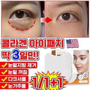[효과보장] 미국기술 10+10/20+20 콜라겐 눈밑 지방제거 패치 아이패치 다크서클 비립종 제거 아이팩 아이백 크림 주름개선 리프팅팩 아이케어, 1개, 10개입