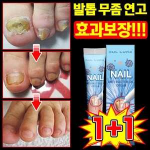 [빠른 배송] 내성 발톱 연고 무좀약 손톱 발톱 치료제 문제성 손발톱 영양제 풋 솔루션 케어 앰플, 2개, 20g