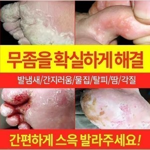 {국내 배송/일본 도쿄 R&D} 발 냄새를 빠르게 제거 / 무좀소독 / 가려움증 방지 및 살균 / 발 필링 / 발흘림 / 발흘림 / 물집 / 기타 발 관리LY009, 2개, 20g