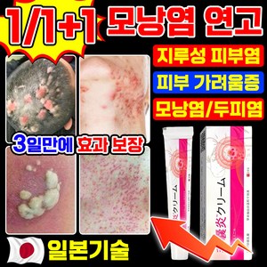 [당일출고] 일본 모낭염 연고 피부가려움증 지루성피부염 연고 여드름 크림 포장증정, 2개, 20.1g