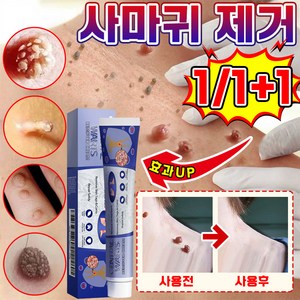 [국내배송] 1+1/2+2 미국 피부 치료 편평 연고 신속하고 효과적인 기미 비립종 제거 스킨 제거 크림 최저가격 포장증정, 1개, 20g