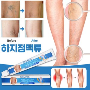 하지정맥류 크림 정맥류 연고 혈관염 다리부종 혈액순환 붓기크림 포장증정, 1개, 20ml