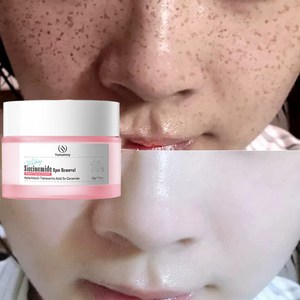 트리트먼트 크림 및 피부 개선, 1개, 50ml