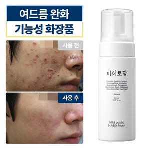 [바이로담] 여드름기능성 트러블진정 약산성 버블폼, 1개, 150ml