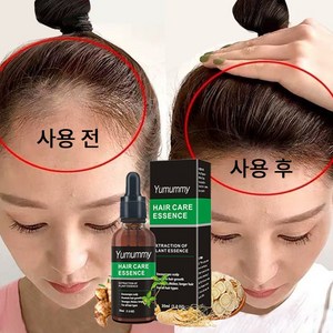 Hair Hair Grower 두피 케어 세럼 발모제, 2개, 30ml