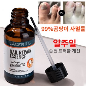 [국내배송] 발톱무좀 손발톱 쓱싹크림 케어 전용 쓱싹크림, 1개, 30ml