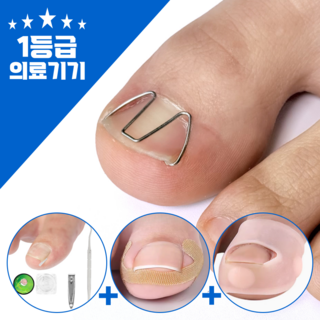[1등급신고의료기기] 메디아르 내성발톱 교정기 관리용품 패키지, 1세트