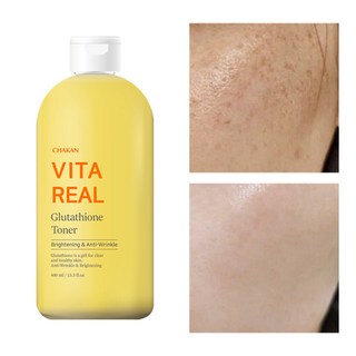 1. 기미 잡티 주근..