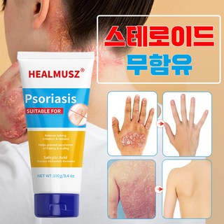 [당일배송]건선연고 피부 가려움증 대상포진 지루성피부염 아토피 피부염 발진 피부 진정 크림 건선크림, 1개, 100ml