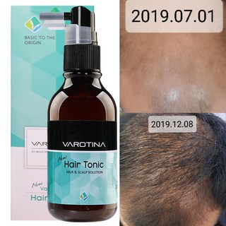 바로티나 탈모양양제