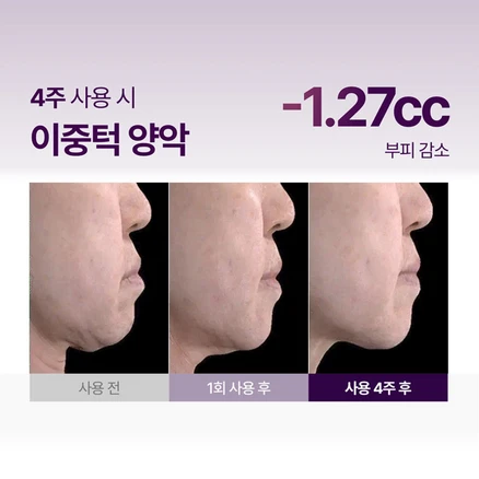 메디테라피 인모톡스 텐션 업 마스크 1박스 안면거상마스크 안면거상필름 안면거상패치 리프팅마스크 하이드로겔마스크 양악리프팅 윤곽마스크 리프팅, 1세트, 5개입